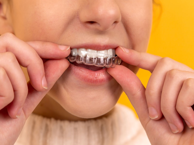 Cấy ghép Implant — trước điều trị